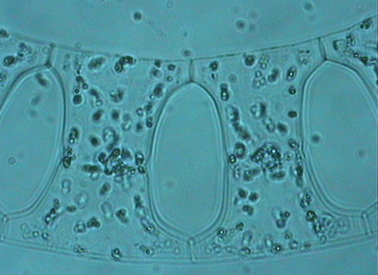 Dictyocha speculum